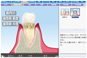 動画による解説