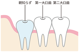 正常に生えている場合