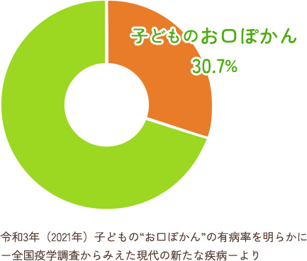 日本の子どもの約30％に及ぶ「お口ぽかん」