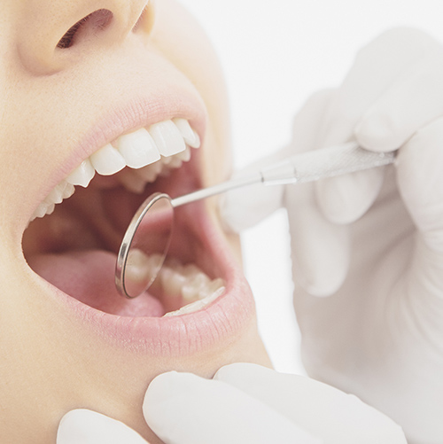 患者さまそれぞれのお口のリスクを考えた予防歯科医療を行う